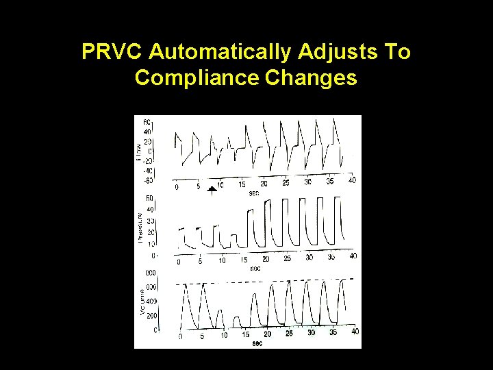 PRVC Automatically Adjusts To Compliance Changes 