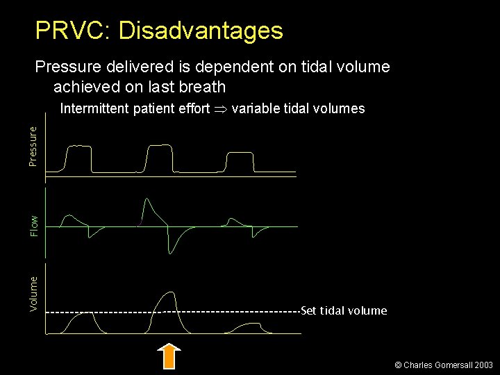 PRVC: Disadvantages Pressure delivered is dependent on tidal volume achieved on last breath Volume