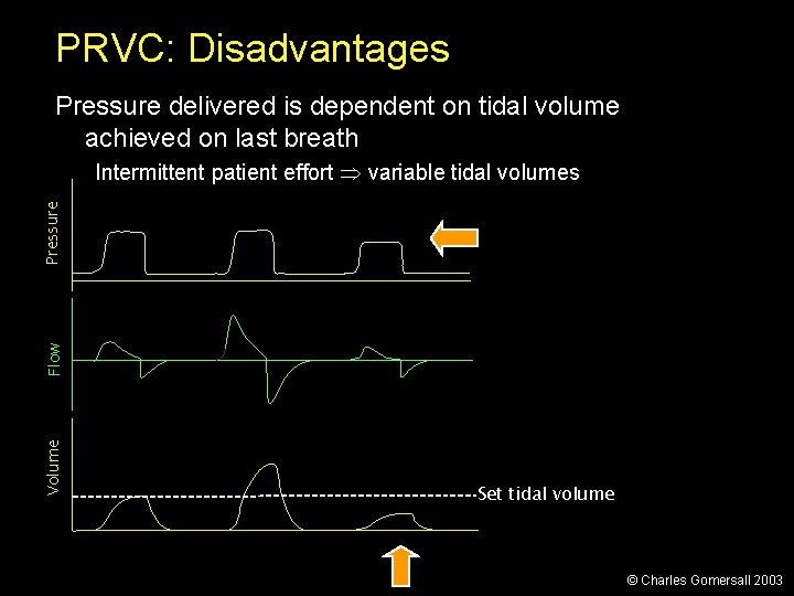 PRVC: Disadvantages Pressure delivered is dependent on tidal volume achieved on last breath Volume