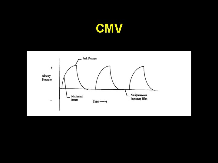 CMV 