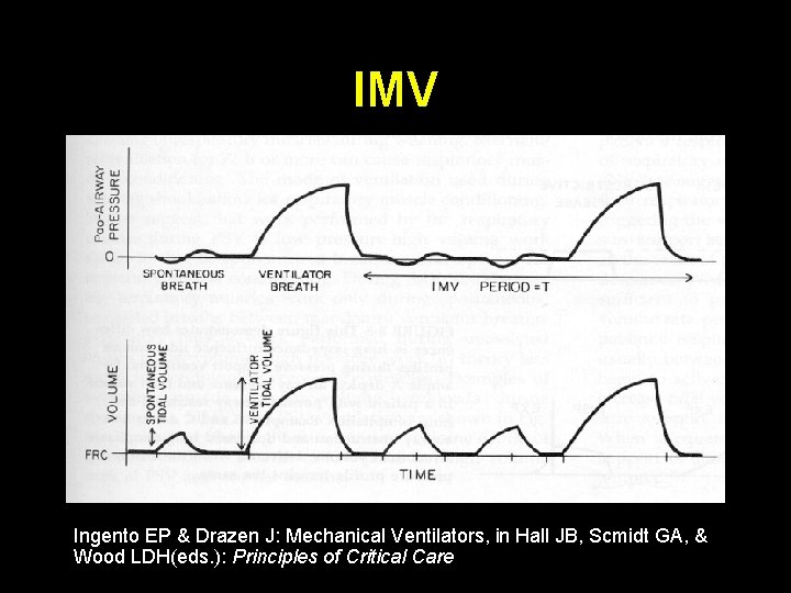 IMV Ingento EP & Drazen J: Mechanical Ventilators, in Hall JB, Scmidt GA, &