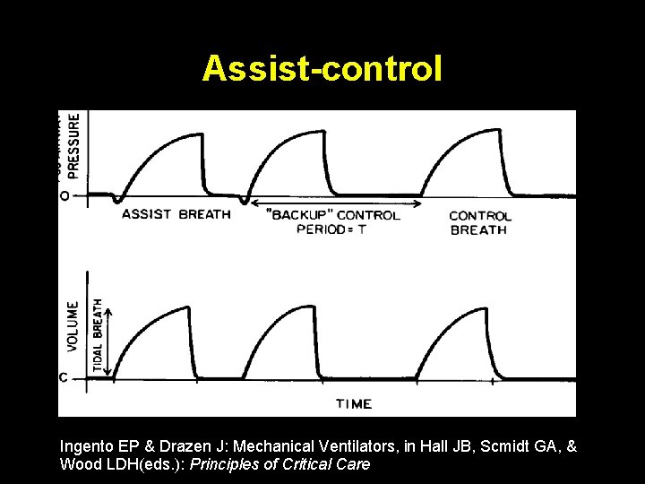 Assist-control Ingento EP & Drazen J: Mechanical Ventilators, in Hall JB, Scmidt GA, &