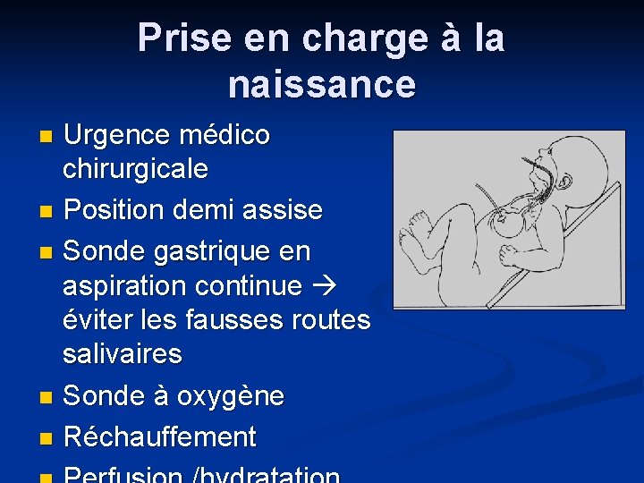 Prise en charge à la naissance Urgence médico chirurgicale n Position demi assise n