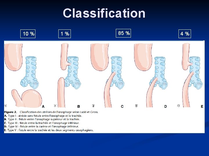 Classification 10 % 1% 85 % 4% 