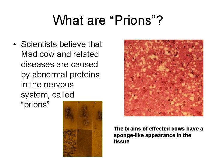 What are “Prions”? • Scientists believe that Mad cow and related diseases are caused