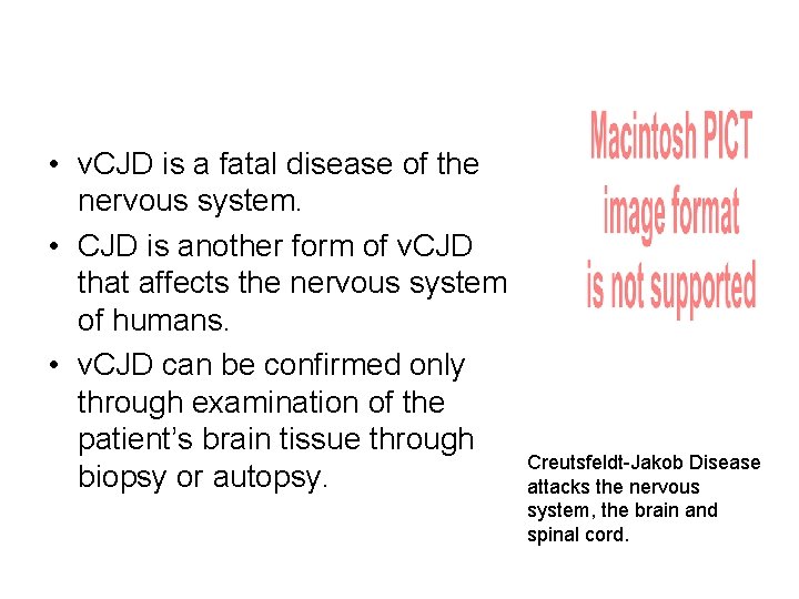 • v. CJD is a fatal disease of the nervous system. • CJD