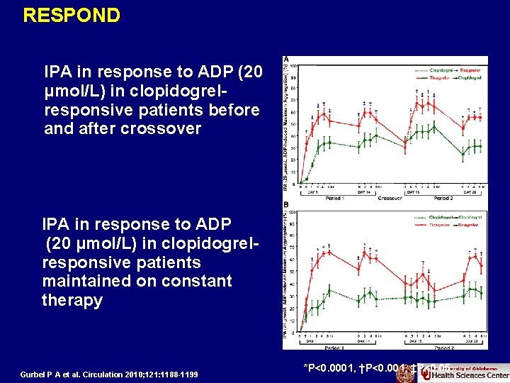 RESPOND IPA in response to ADP (20 μmol/L) in clopidogrelresponsive patients before and after
