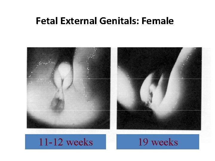 Fetal External Genitals: Female 11 -12 weeks 19 weeks 