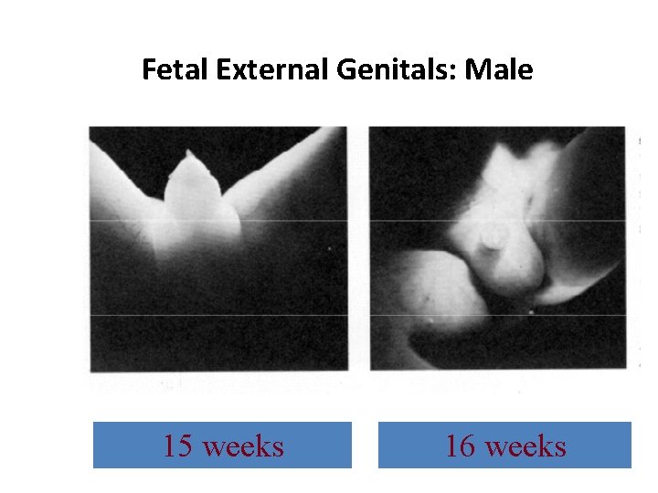 Fetal External Genitals: Male 15 weeks 16 weeks 