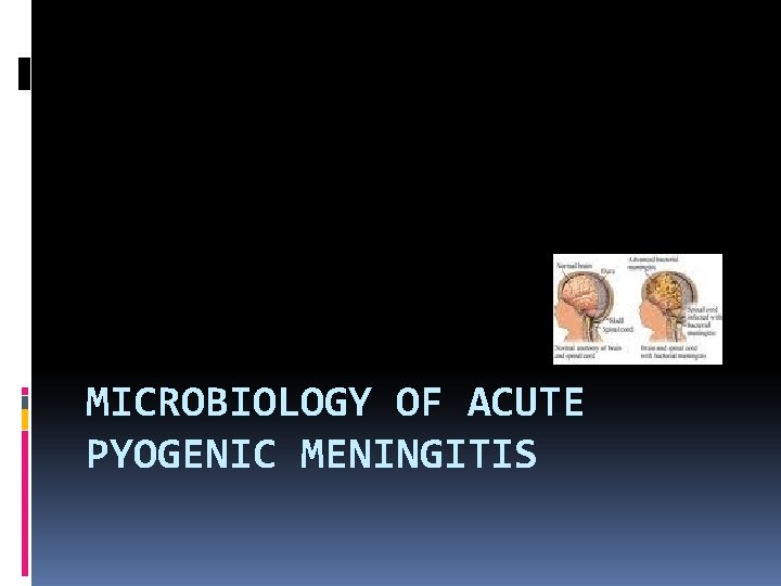 MICROBIOLOGY OF ACUTE PYOGENIC MENINGITIS 