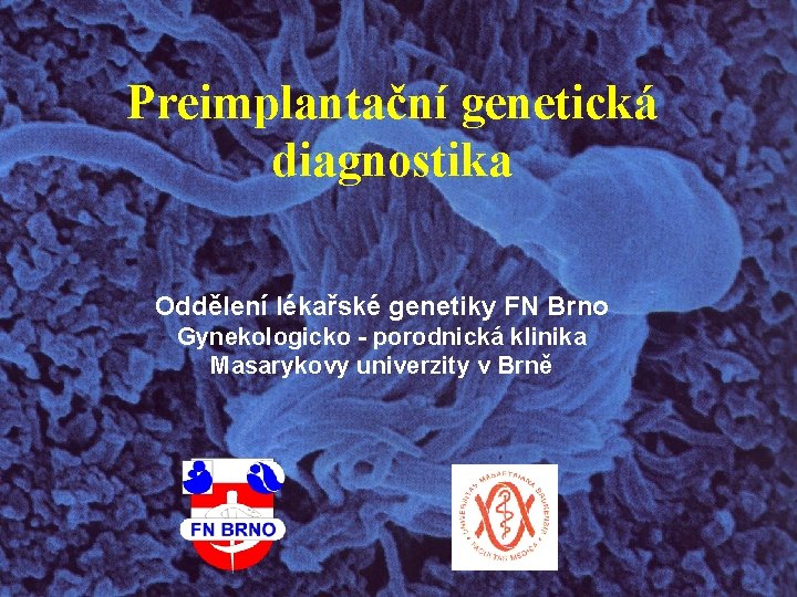 Preimplantační genetická diagnostika Oddělení lékařské genetiky FN Brno Gynekologicko - porodnická klinika Masarykovy univerzity