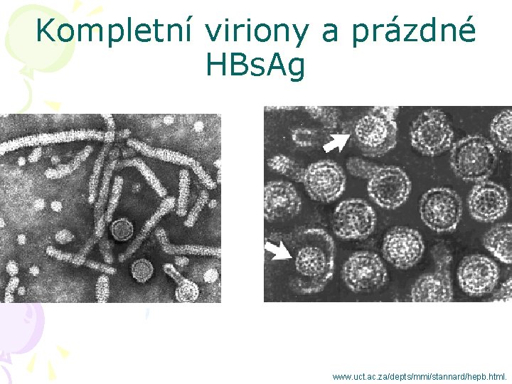 Kompletní viriony a prázdné HBs. Ag www. uct. ac. za/depts/mmi/stannard/hepb. html. 