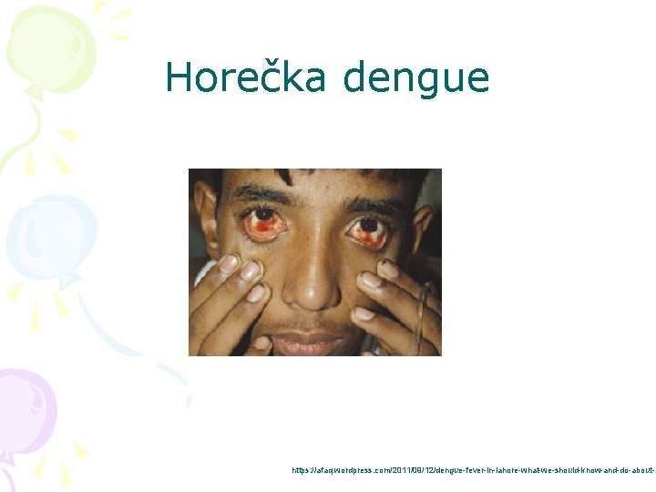 Horečka dengue https: //afaq. wordpress. com/2011/09/12/dengue-fever-in-lahore-what-we-should-know-and-do-about-i 