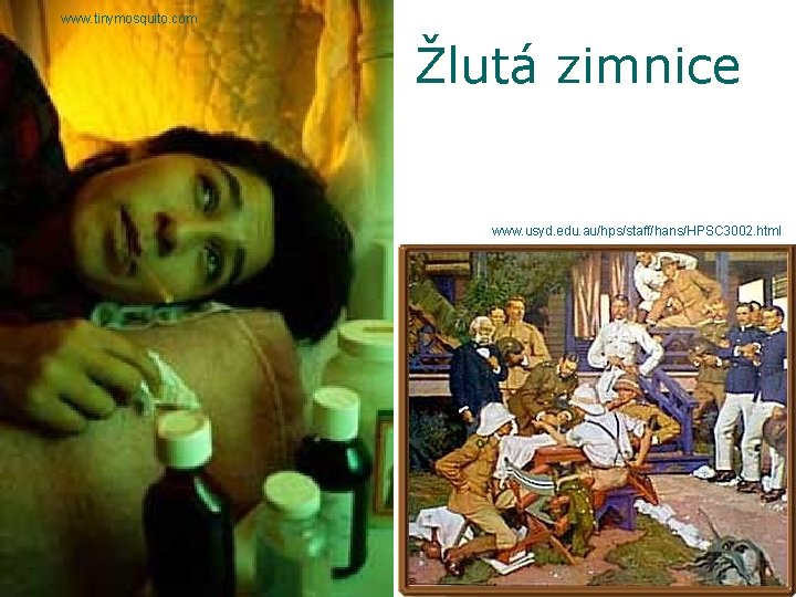 www. tinymosquito. com Žlutá zimnice www. usyd. edu. au/hps/staff/hans/HPSC 3002. html 