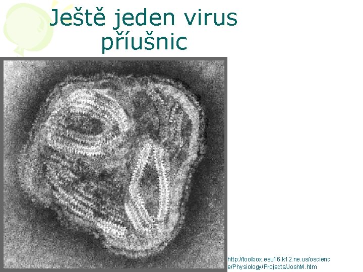 Ještě jeden virus příušnic http: //toolbox. esu 16. k 12. ne. us/oscienc e/Physiology/Projects/Josh. M.