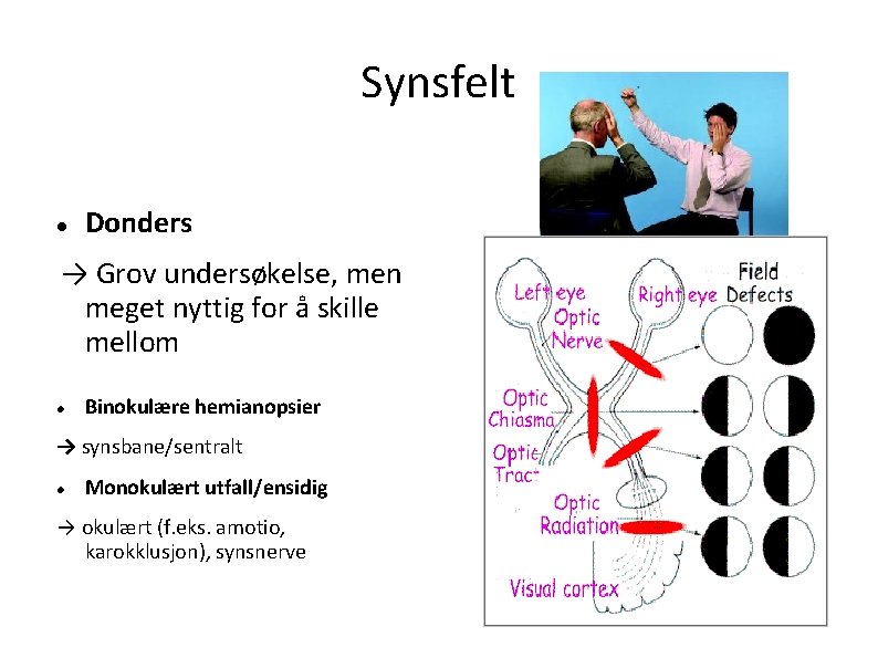 Synsfelt Donders → Grov undersøkelse, men meget nyttig for å skille mellom Binokulære hemianopsier