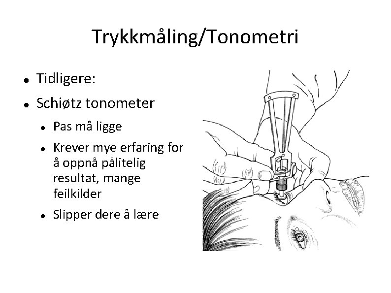 Trykkmåling/Tonometri Tidligere: Schiøtz tonometer Pas må ligge Krever mye erfaring for å oppnå pålitelig