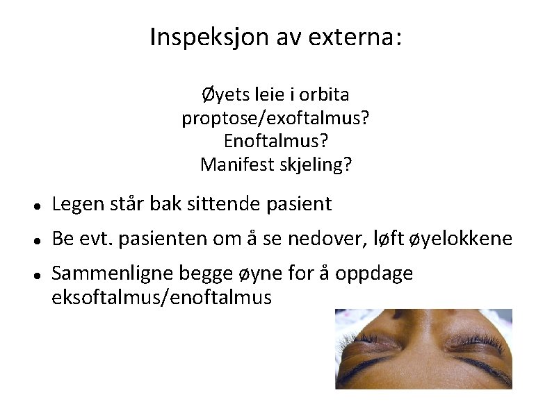 Inspeksjon av externa: Øyets leie i orbita proptose/exoftalmus? Enoftalmus? Manifest skjeling? Legen står bak