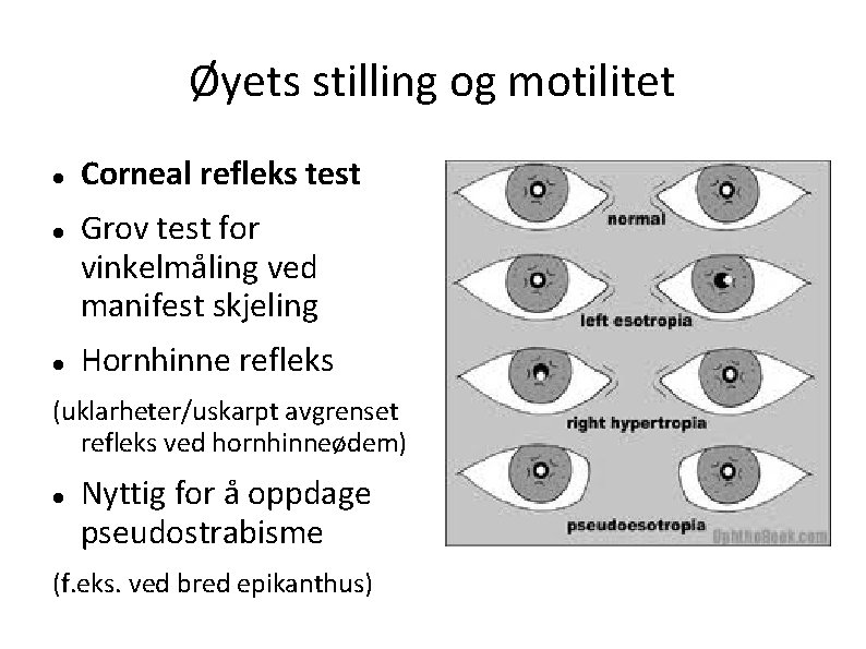 Øyets stilling og motilitet Corneal refleks test Grov test for vinkelmåling ved manifest skjeling
