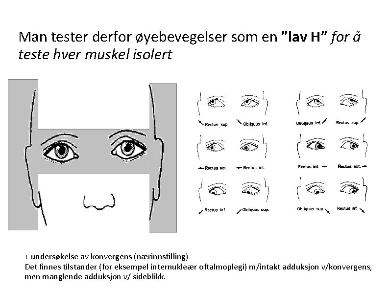 Man tester derfor øyebevegelser som en ”lav H” for å teste hver muskel isolert