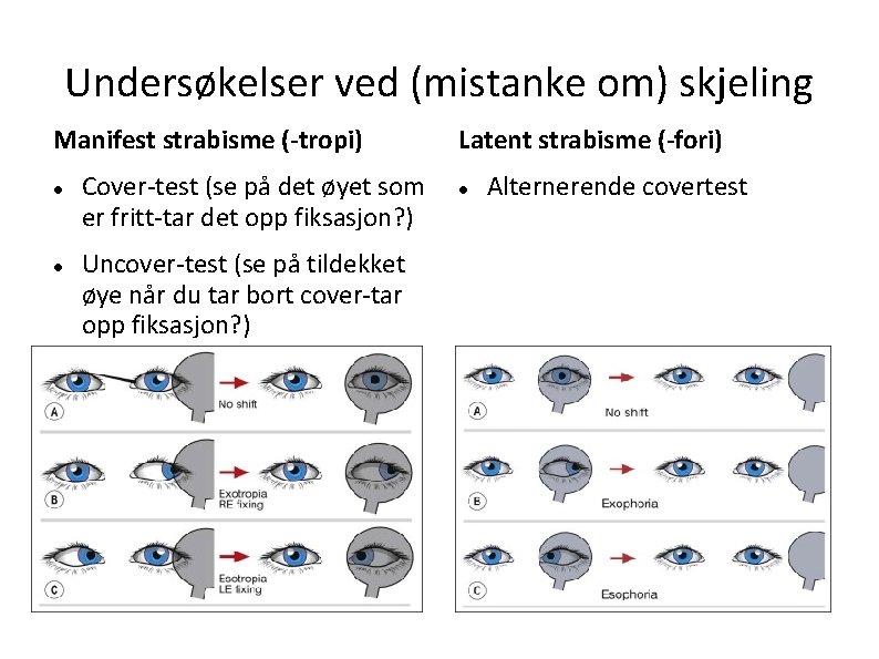 Undersøkelser ved (mistanke om) skjeling Manifest strabisme (-tropi) Cover-test (se på det øyet som