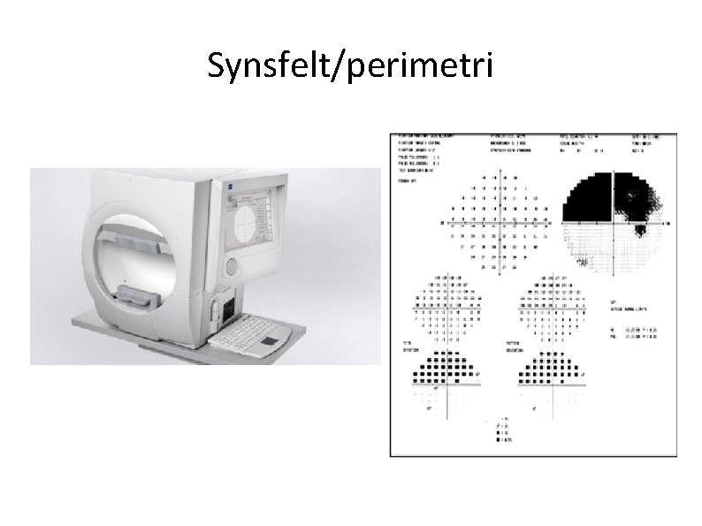Synsfelt/perimetri 