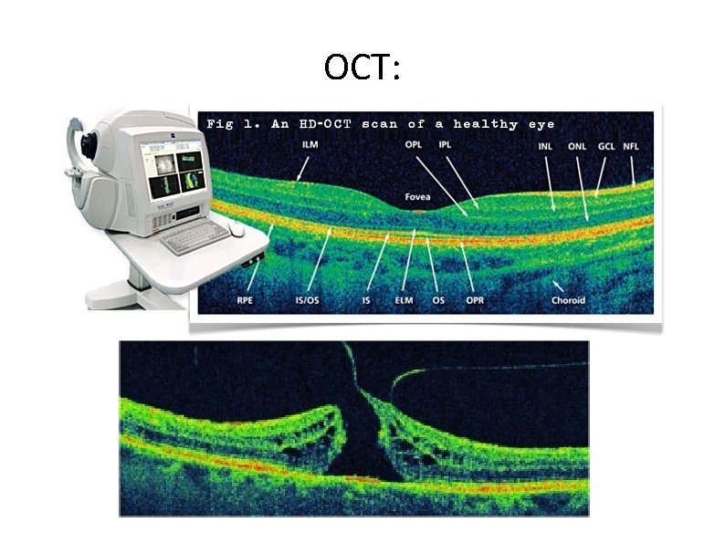 OCT: 