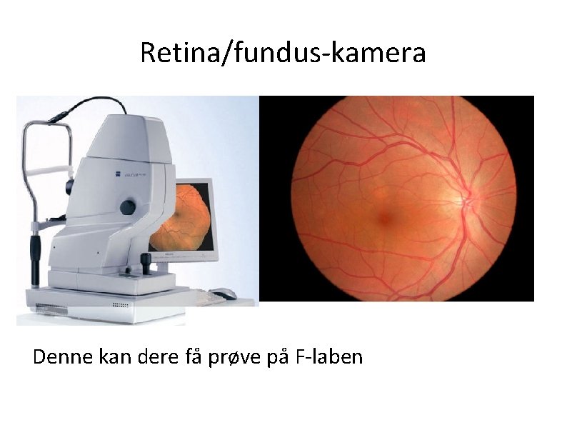 Retina/fundus-kamera Denne kan dere få prøve på F-laben 