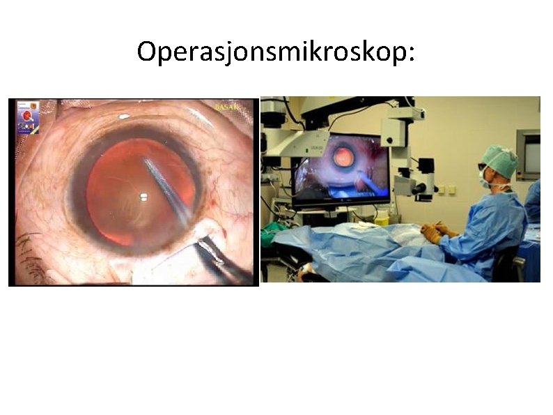 Operasjonsmikroskop: 