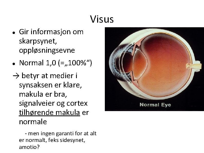 Visus Gir informasjon om skarpsynet, oppløsningsevne Normal 1, 0 (=„ 100%“) → betyr at