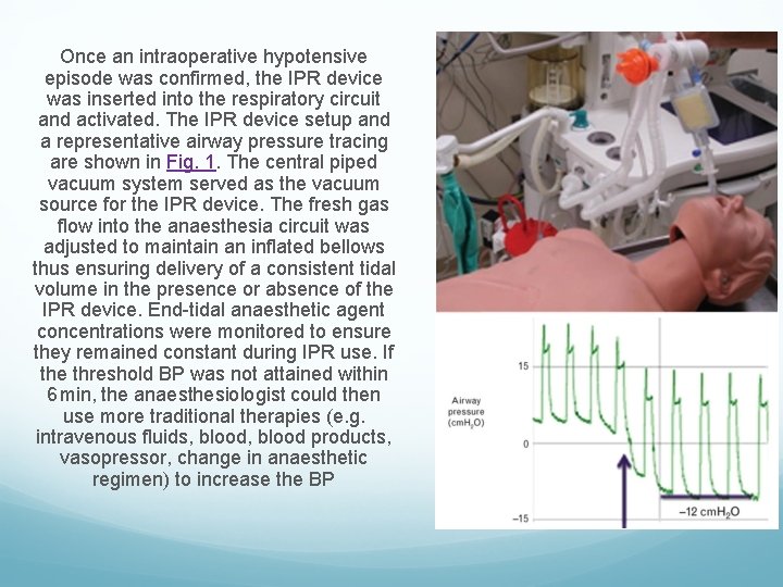 Once an intraoperative hypotensive episode was confirmed, the IPR device was inserted into the