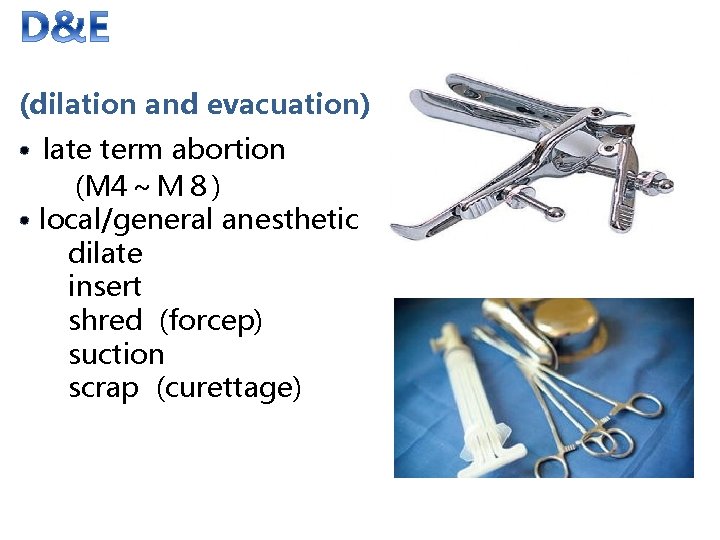 (dilation and evacuation) · late term abortion 　　(M 4～Ｍ８) · local/general anesthetic dilate insert