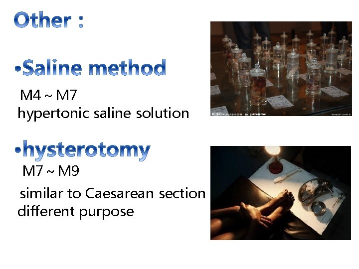  M 4～Ｍ 7 hypertonic saline solution M 7～Ｍ 9 similar to Caesarean section