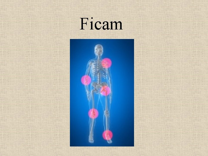 Ficam 