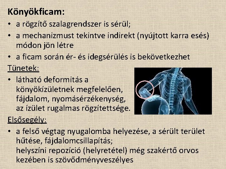 Könyökficam: • a rögzítő szalagrendszer is sérül; • a mechanizmust tekintve indirekt (nyújtott karra