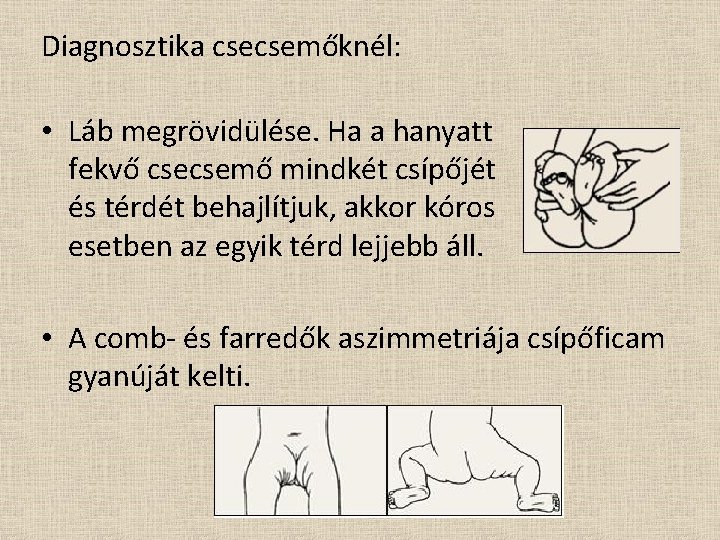 Diagnosztika csecsemőknél: • Láb megrövidülése. Ha a hanyatt fekvő csecsemő mindkét csípőjét és térdét