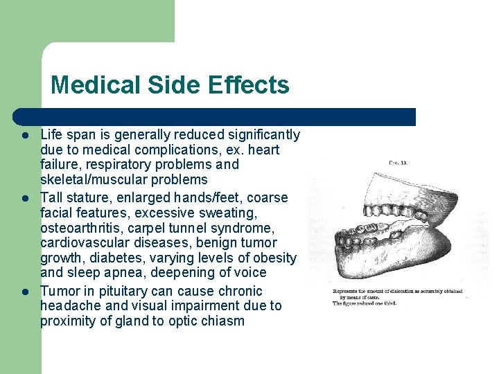 Medical Side Effects l l l Life span is generally reduced significantly due to
