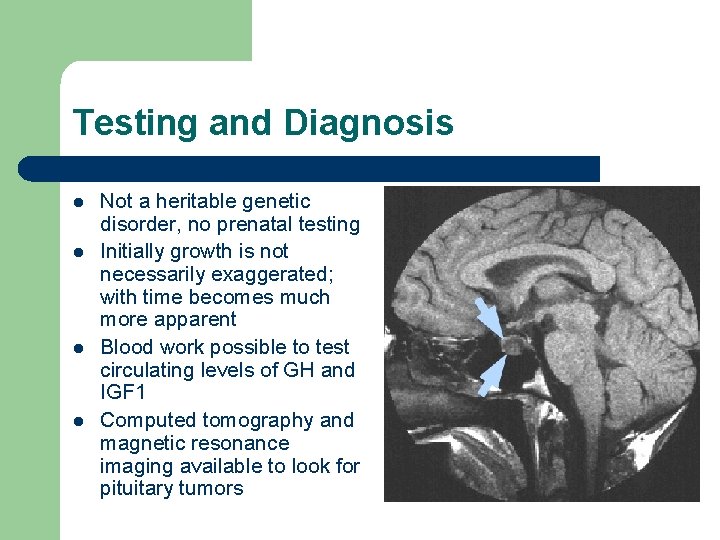 Testing and Diagnosis l l Not a heritable genetic disorder, no prenatal testing Initially