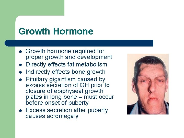 Growth Hormone l l l Growth hormone required for proper growth and development Directly