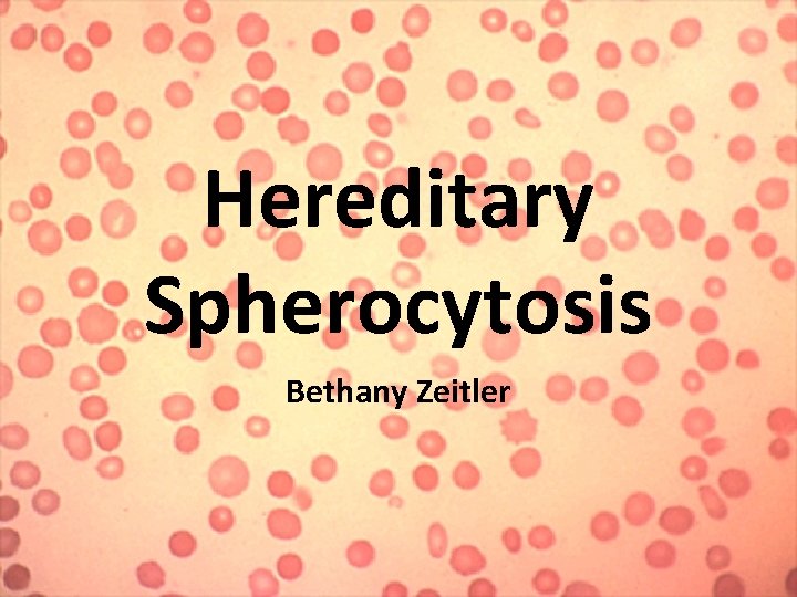 Hereditary Spherocytosis Bethany Zeitler 