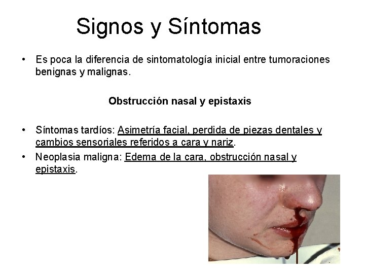 Signos y Síntomas • Es poca la diferencia de sintomatología inicial entre tumoraciones benignas