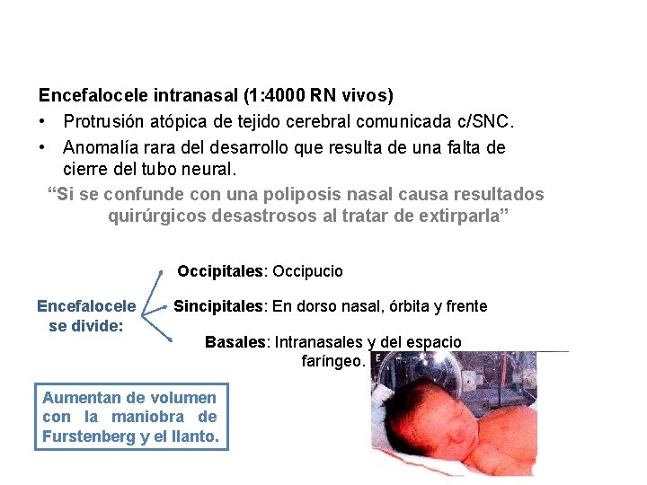 Encefalocele intranasal (1: 4000 RN vivos) • Protrusión atópica de tejido cerebral comunicada c/SNC.