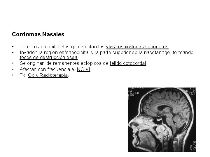 Cordomas Nasales • • • Tumores no epiteliales que afectan las vías respiratorias superiores