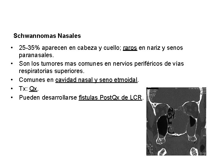 Schwannomas Nasales • 25 -35% aparecen en cabeza y cuello; raros en nariz y