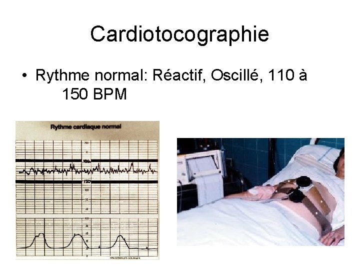 Cardiotocographie • Rythme normal: Réactif, Oscillé, 110 à 150 BPM 