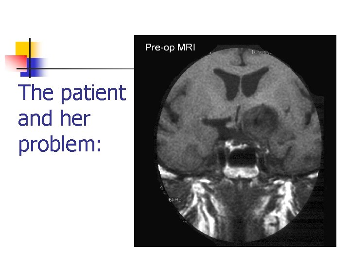 The patient and her problem: 