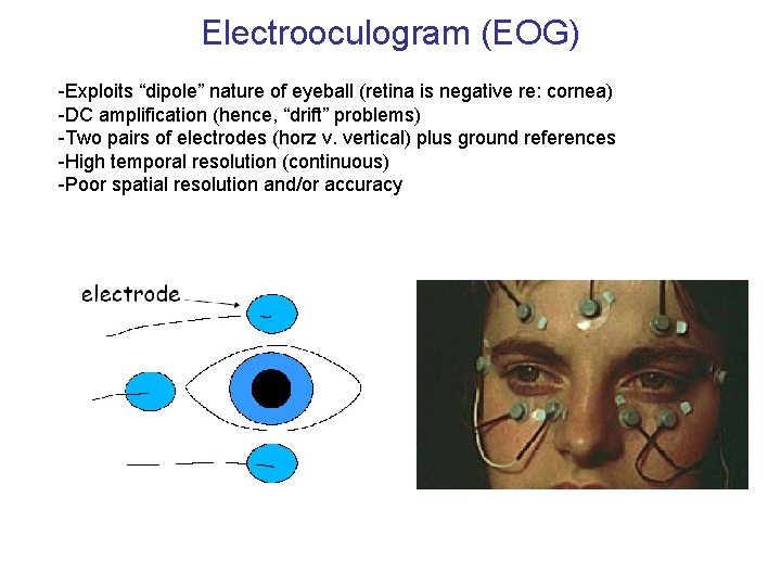 Electrooculogram (EOG) -Exploits “dipole” nature of eyeball (retina is negative re: cornea) -DC amplification Electrooculogram (EOG) -Exploits “dipole” nature of eyeball (retina is negative re: cornea) -DC amplification