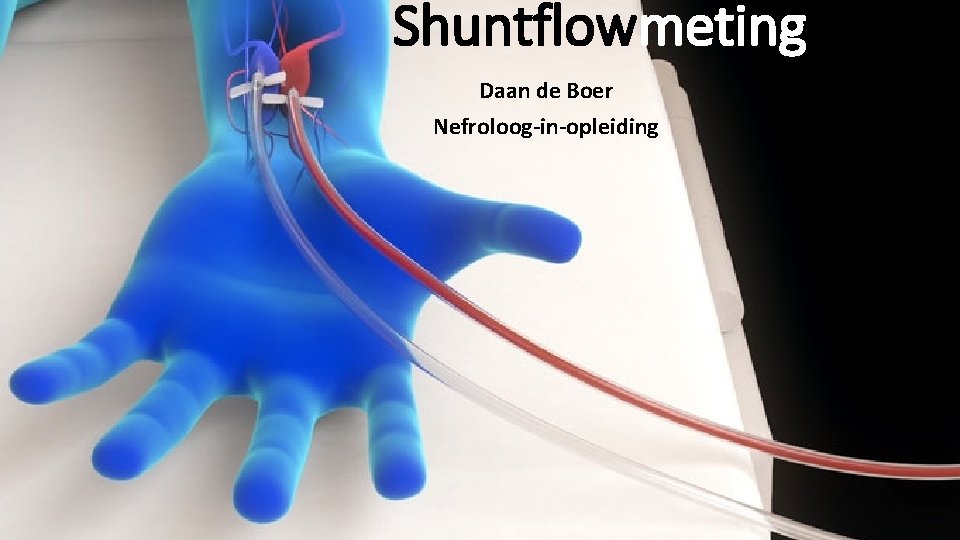 Shuntflowmeting Daan de Boer Nefroloog-in-opleiding 