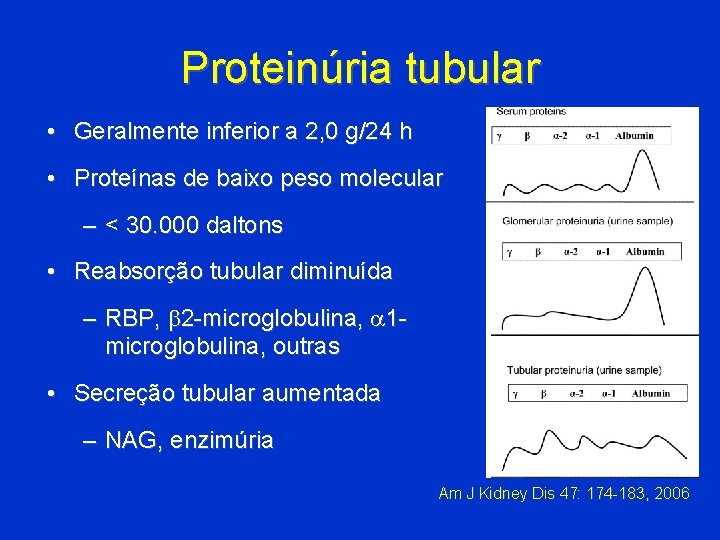 Proteinúria tubular • Geralmente inferior a 2, 0 g/24 h • Proteínas de baixo
