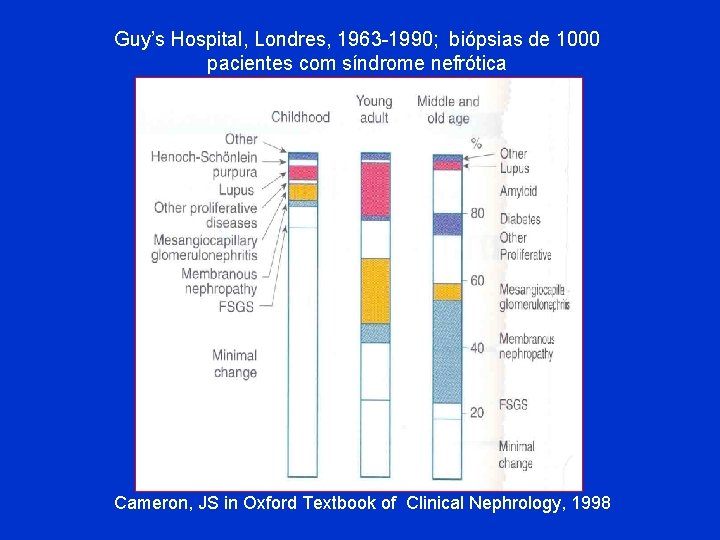 Guy’s Hospital, Londres, 1963 -1990; biópsias de 1000 pacientes com síndrome nefrótica Cameron, JS